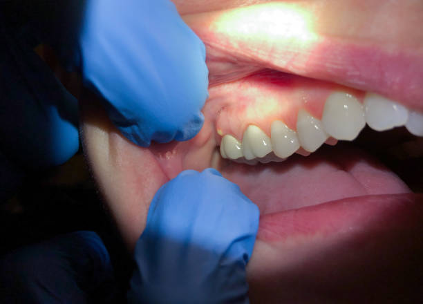 Best Emergency Dental Care for Trauma or Injury in Mcgehee, AR