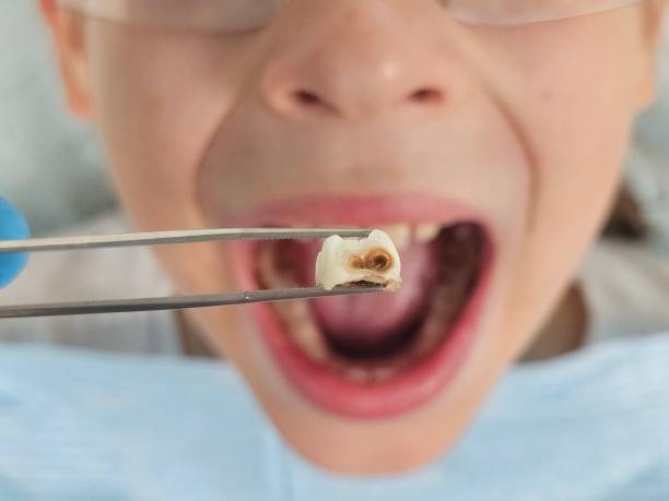 Best Walk-In Emergency Dentist in Mcgehee, AR